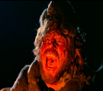 Waaaahhhh!!! Rats are eating my head!!!!!